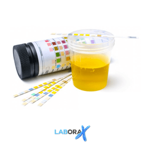 pemeriksaan profil urin