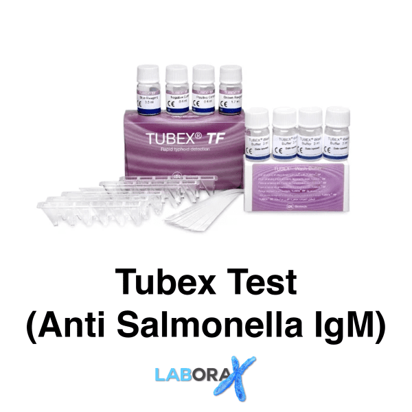tubex test anti salmonella igm