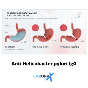 Anti Helicobacter pylori IgG